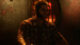 Wolverine directors explain why Insomniac’s latest game has the Weapon X-factor